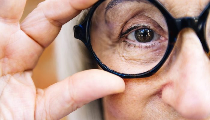 Degenerazione Maculare Senile: Come Prevenirla?